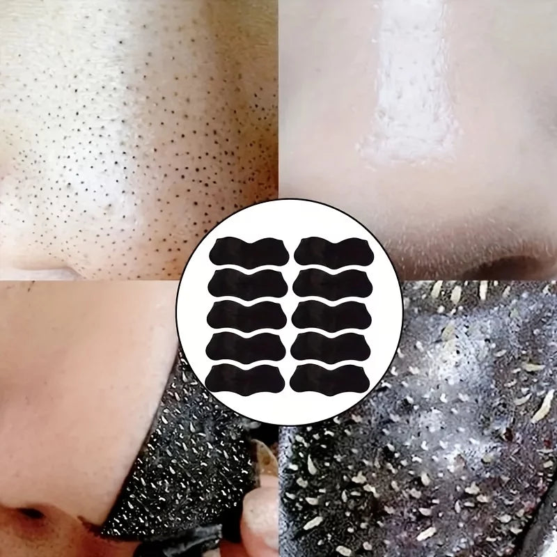 Unblocking Natural Nose Cleansing Pores, By For Three To 100pc Remove Instantly Using Skin Patch Patch, Oil To Oily Deep Pore Reduce A Times Charcoal Blackheads,