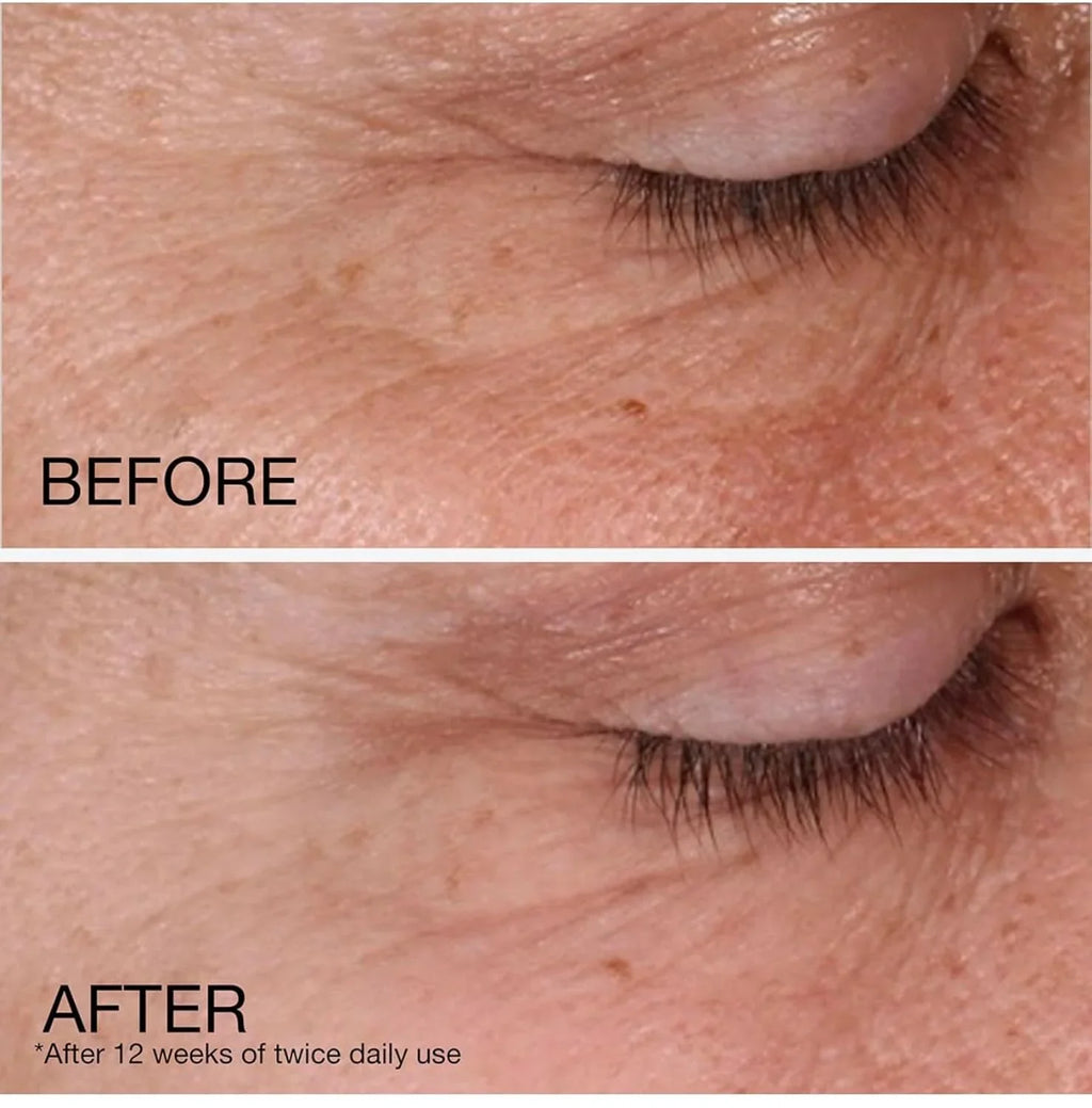 Cream Lines, Wrinkles, Face Face Fight Daily Acid Rapid Fragrance Moisturizer, Free, and Spots, Wrinkle Neutrogena Retinol to Dark Hyaluronic with Repair Retinol and 1.7 Fine Anti-Aging