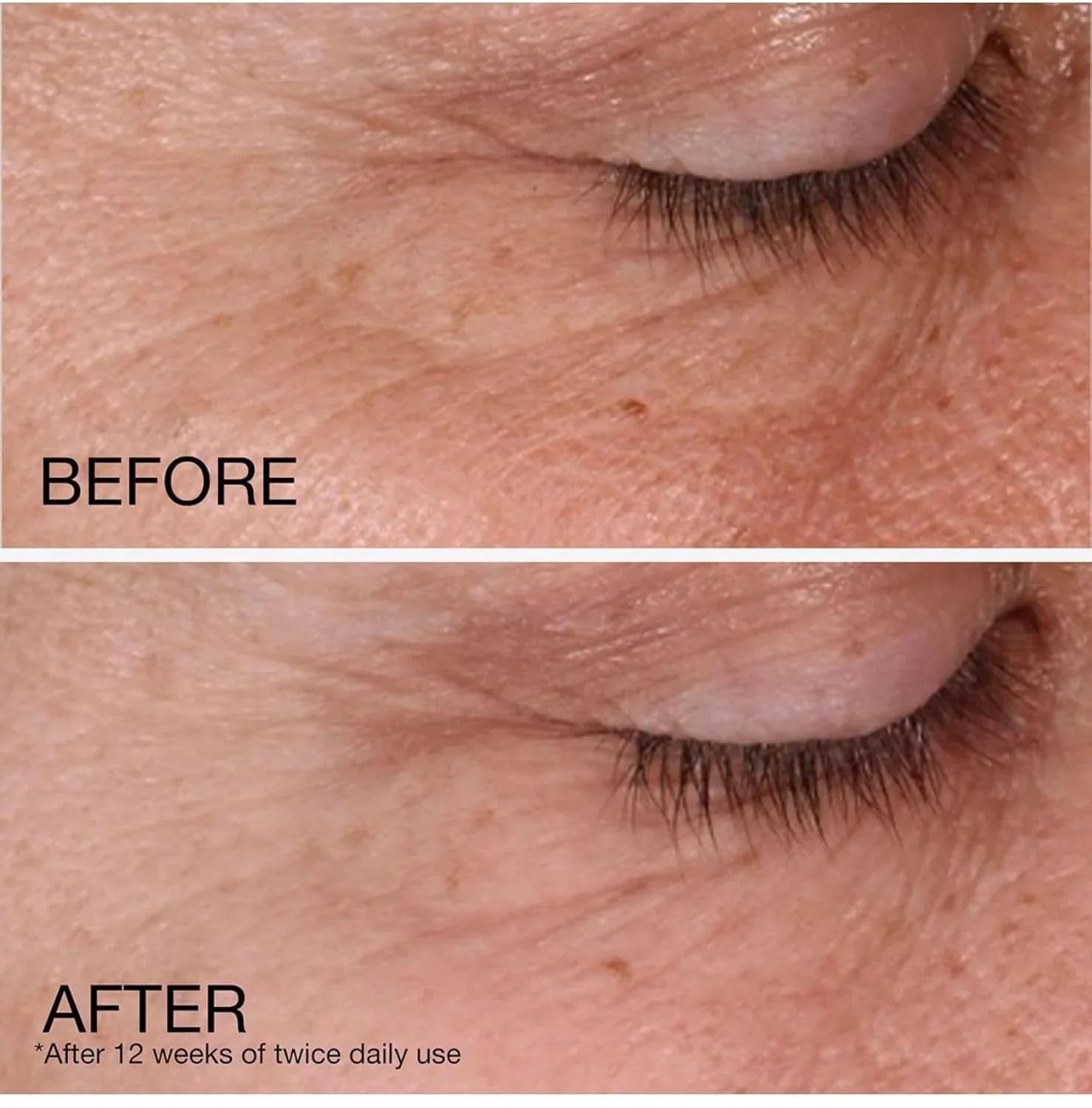 Cream Lines, Wrinkles, Face Face Fight Daily Acid Rapid Fragrance Moisturizer, Free, and Spots, Wrinkle Neutrogena Retinol to Dark Hyaluronic with Repair Retinol and 1.7 Fine Anti-Aging