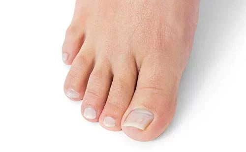 Renewal, Treatment, Tratamiento USA Extra Nail Para Strength Oriundo in Nail Made Life Uñas,