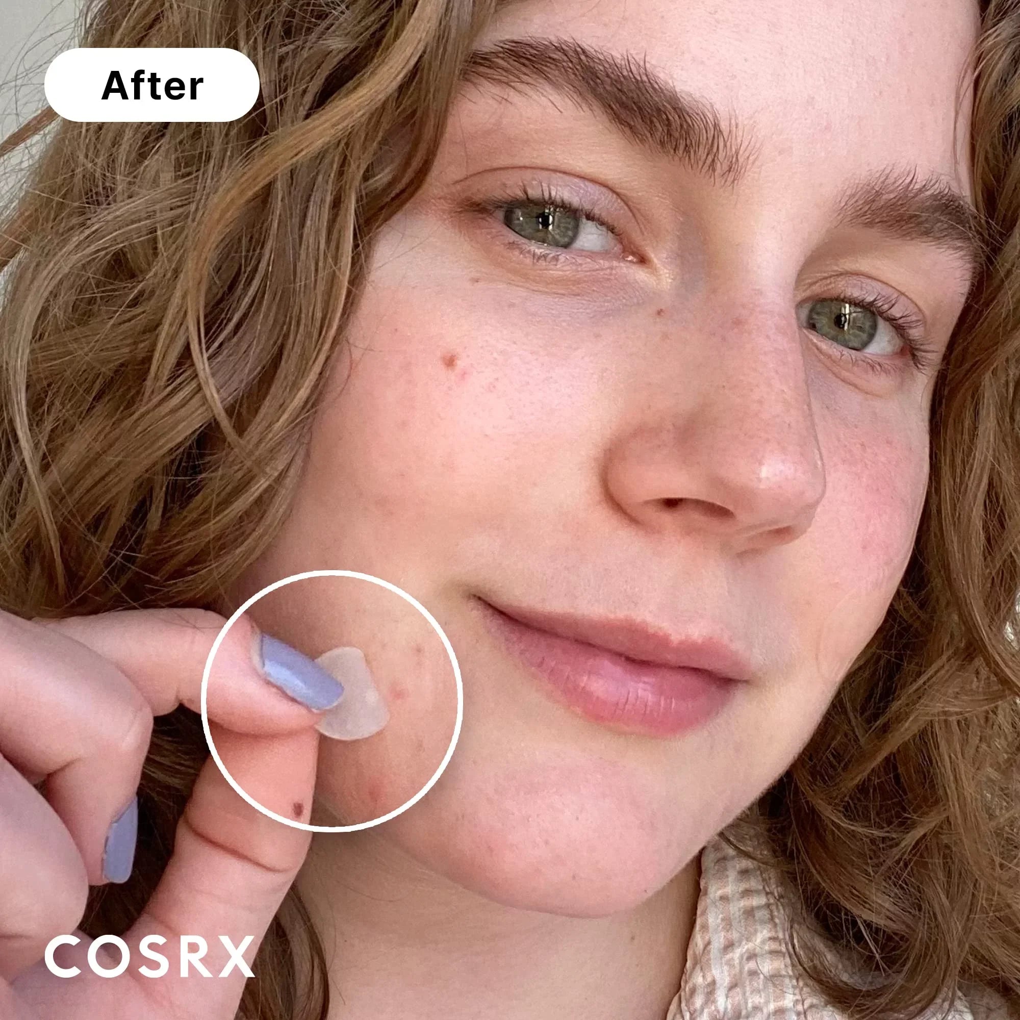 Ingredients Animals, For Absorbing Tested Face Acne (Pack. On Toxic Original Not Cosrx No 3 Stickers And For Zits Body, Pimple And Count Spot Hydrocolloid (240 Size Patches Blemishes Patch Cover,