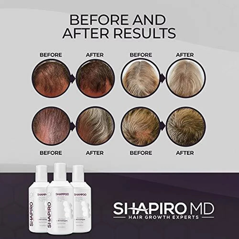 Vegan ounce Shapiro DHT MD Hair Month) Loss Formula 8 Fighting Shampoo, (1 for Thinning Hair,
