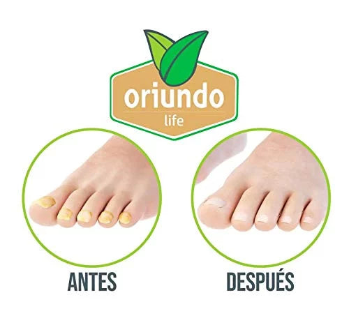 Renewal, Treatment, Tratamiento USA Extra Nail Para Strength Oriundo in Nail Made Life Uñas,