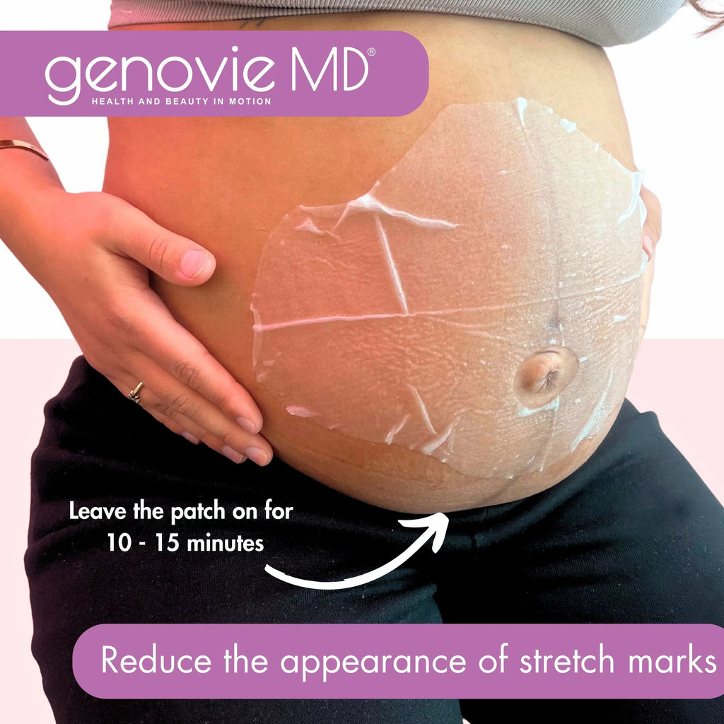 Stretch MD Mark Patch GENOVIE Maternal Miracle