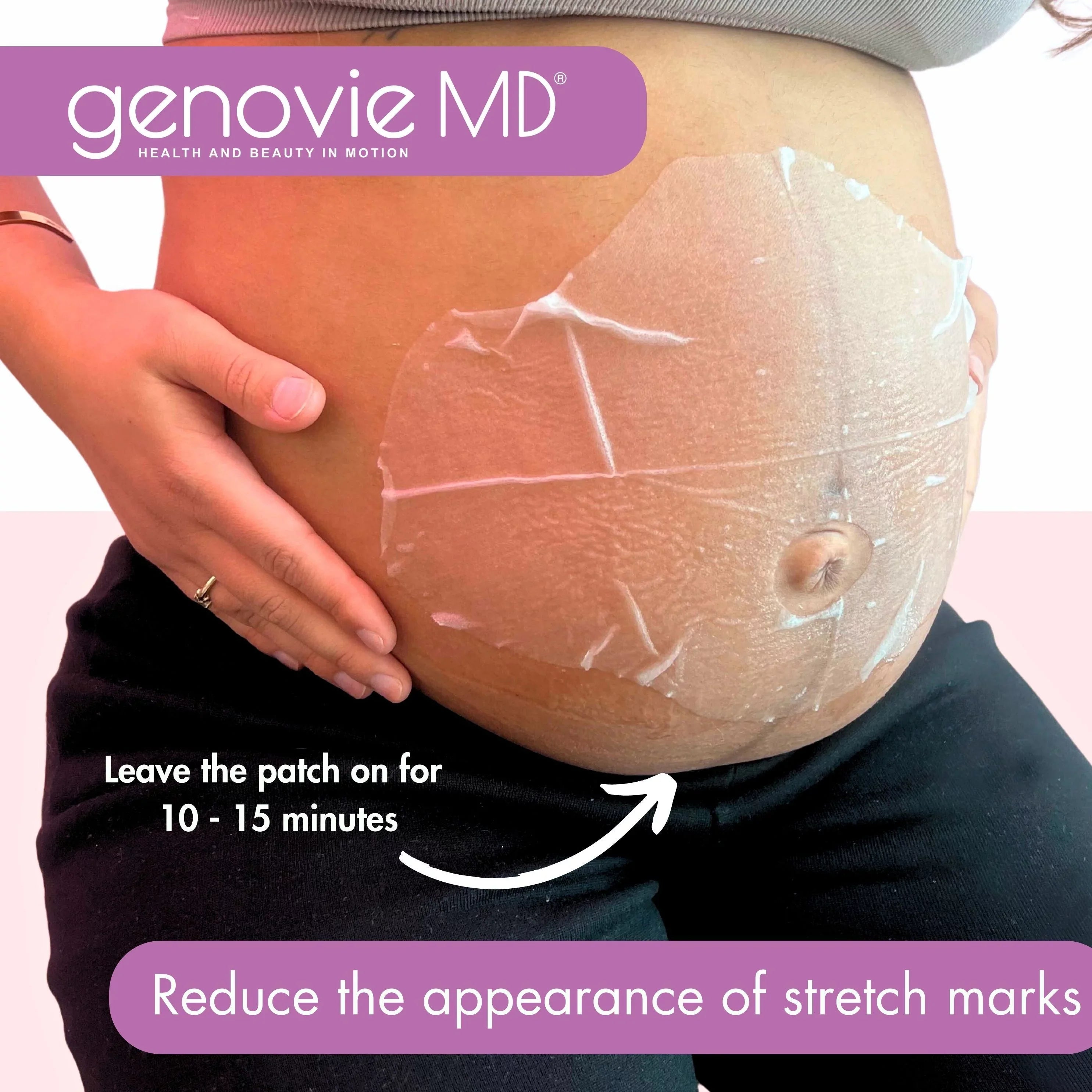 Stretch MD Mark Patch GENOVIE Maternal Miracle